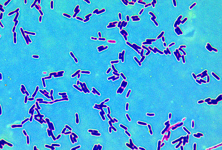 BÀI 26: Thực hành quan sát vi khuẩn. Tìm hiểu các bước làm sữa chua - Hoc24